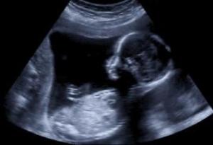 C3D1538A-BA60-46AB-8E86-201D82192383